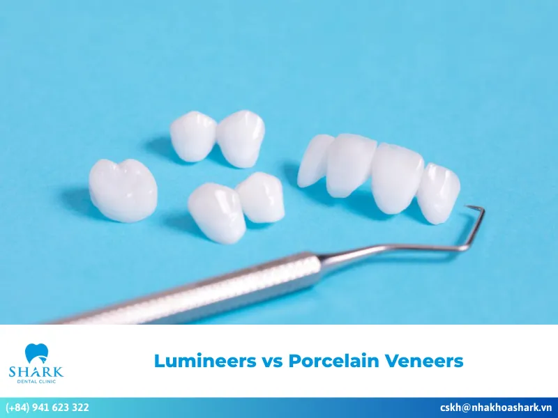 Lumineers vs Porcelain Veneers