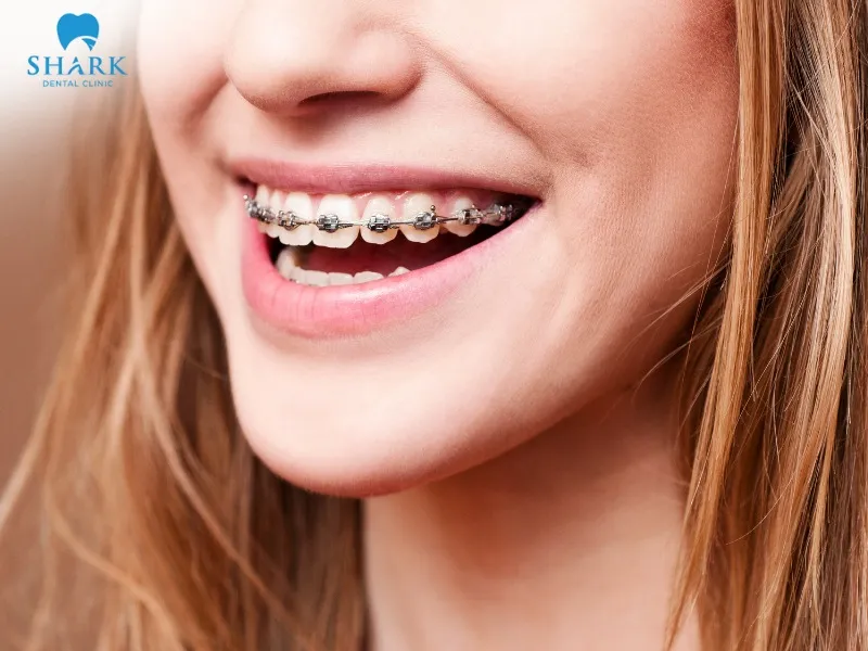 If the tooth mobility is within the normal range, you may only feel mild soreness