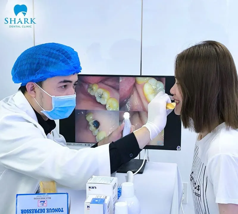 You should visit the dental clinic directly so the dentist can thoroughly advise you on the costs of both methods, helping you make the most appropriate choice