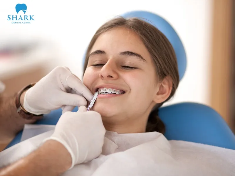 The age range of 12–16 years old is considered the “golden period” for orthodontic treatment