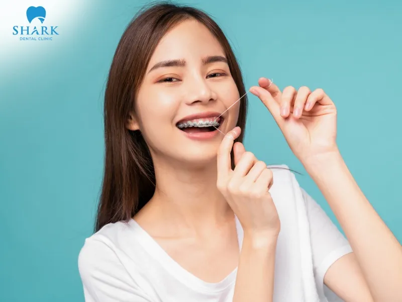 Braces help move teeth into their correct positions, while a retainer supports stabilizing the teeth after alignment