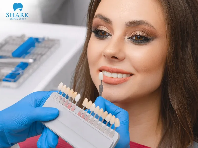 Depending on your needs and actual conditions, you can choose either dental caps or porcelain veneers