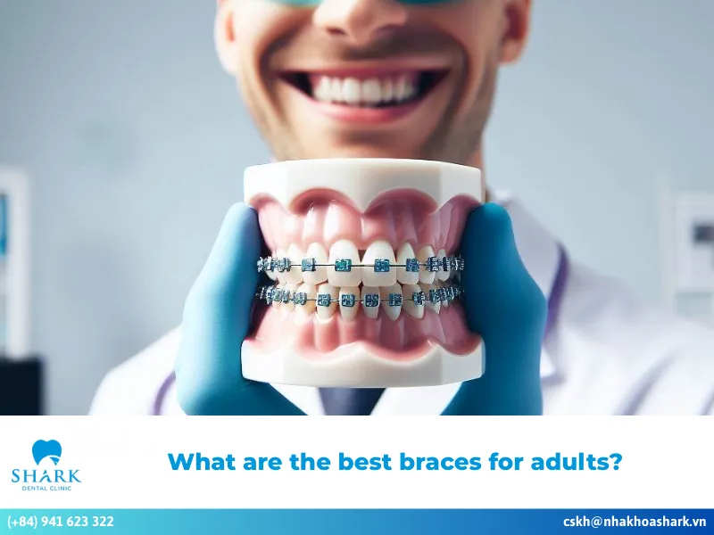 What are the best braces for adults?