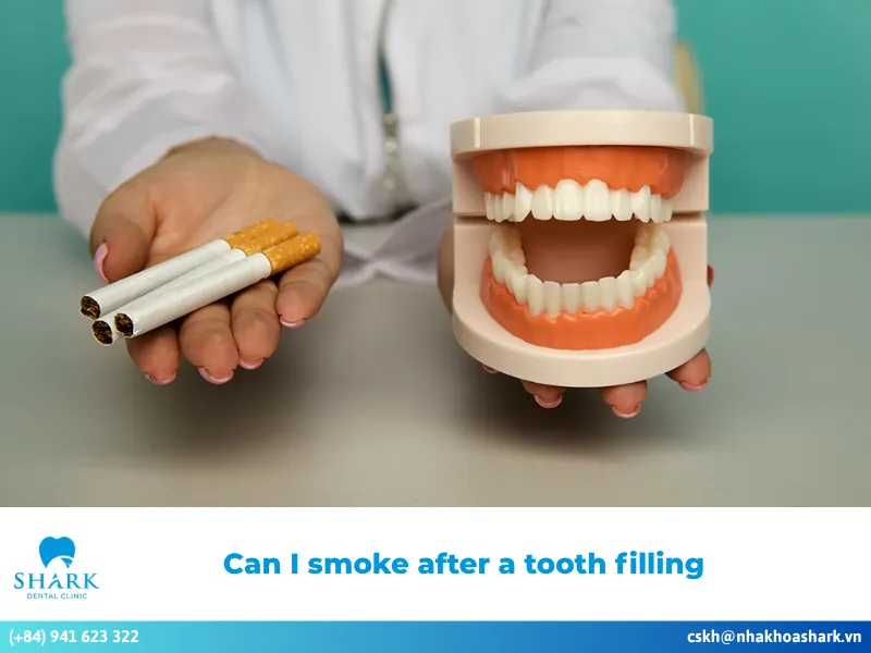 Answering the question: Can I smoke after a tooth filling?