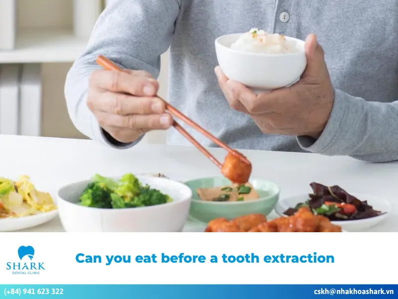 Can you eat before a tooth extraction? Key notes to remember