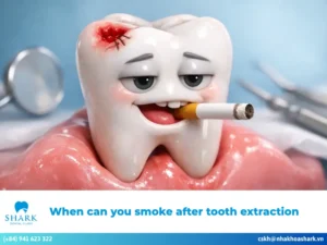 When can you smoke after tooth extraction? Risks of using