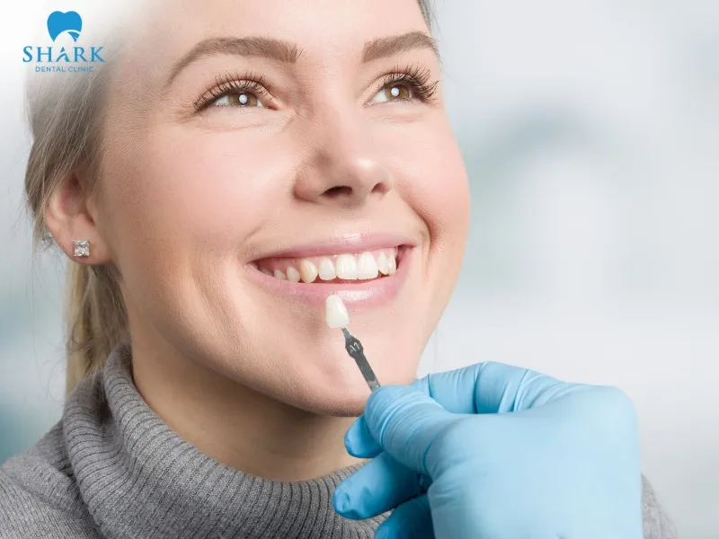 Lithium disilicate veneers provide high aesthetic effectiveness while preserving most of the natural tooth structure