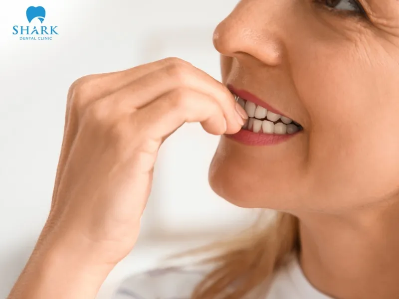 To protect glass-ceramic veneers, you need to eliminate harmful habits such as nail biting, teeth grinding, and similar behaviors that may damage the veneers