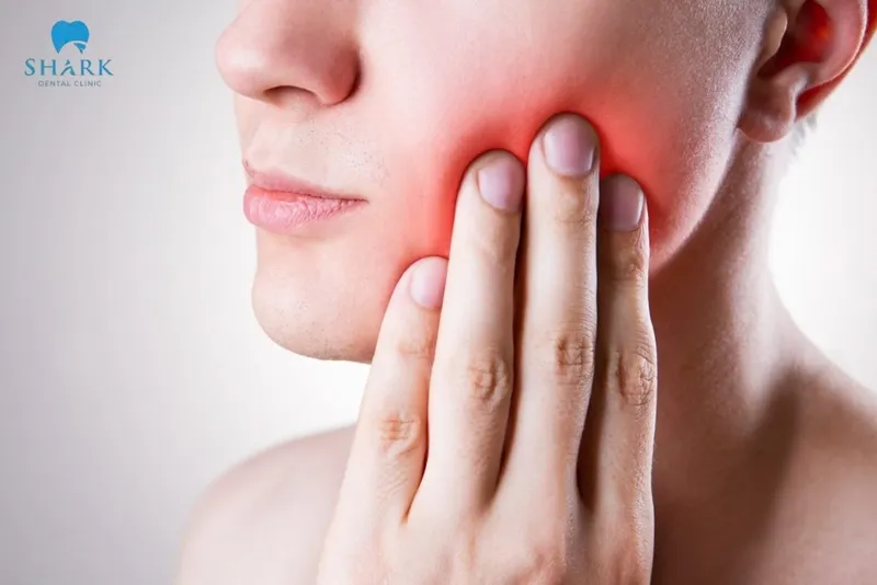 Smoking after a tooth filling may lead to tooth sensitivity, gum irritation, and discomfort in the surrounding soft tissues of the recently treated area