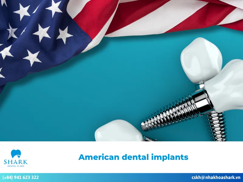Comparing American dental implants with other lines today