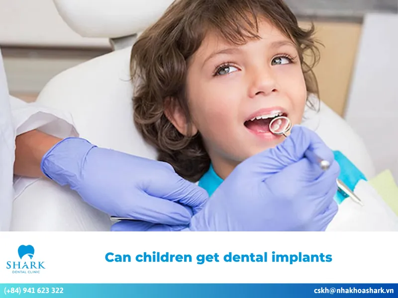Can children get dental implants? What should be considered?