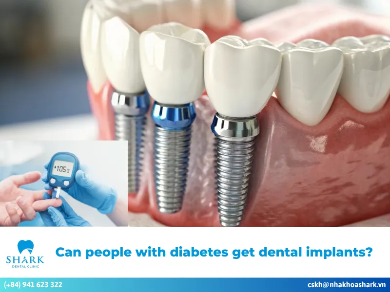 Can people with diabetes get dental implants? Important notes