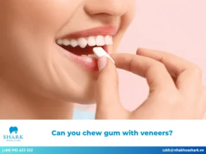Can you chew gum with veneers? Everything you need to know