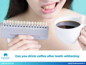 Can you drink coffee after teeth whitening? Why or why not?