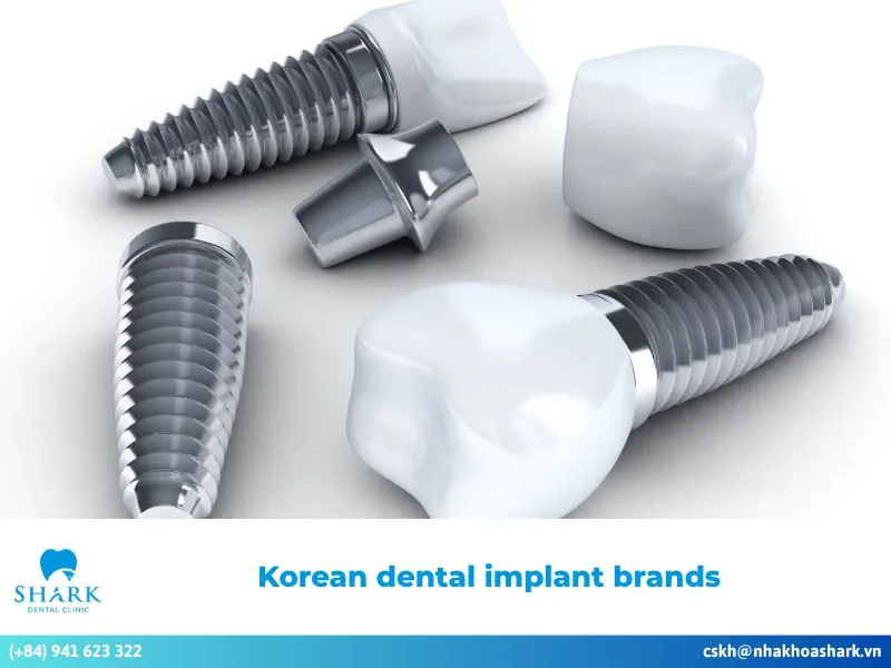 Top Korean dental implant brands that are most popular today