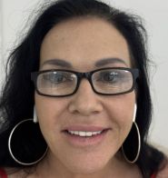 Client Rachelle after procedure 