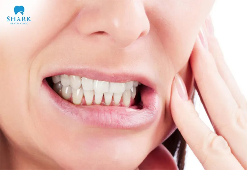 Eliminate harmful habits such as teeth grinding to avoid negative impacts on your oral health and the durability of the filling