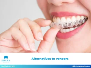 Unveiling the most popular alternatives to veneers today