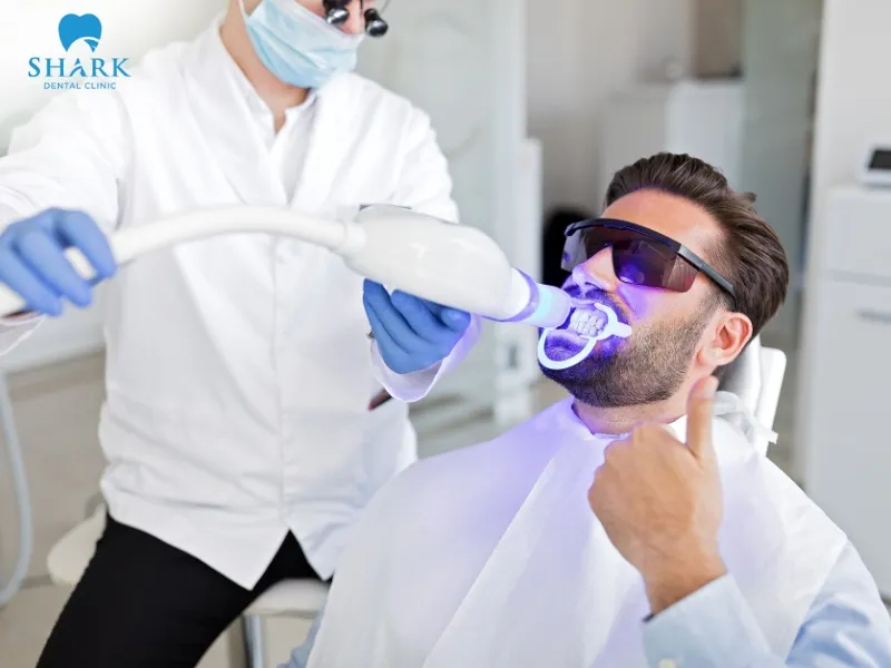 Teeth whitening helps improve tooth color, making the smile appear brighter and more naturally even in tone