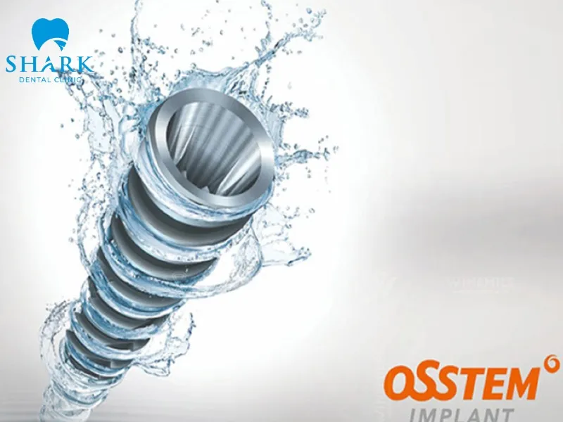 Osstem Korean implants are suitable for both single tooth loss and full-arch restoration cases, depending on individual treatment needs