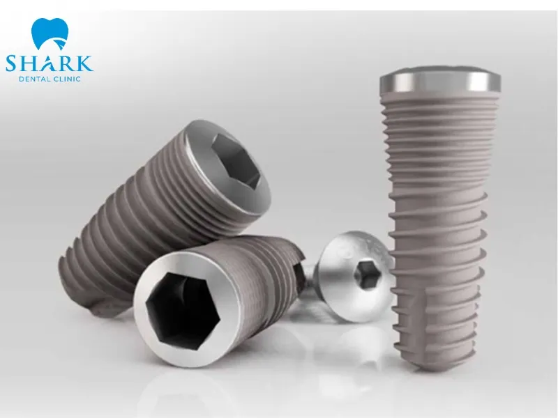 Dentium Korean implants offer a reasonable cost with relatively stable quality, making them a practical option for many patients
