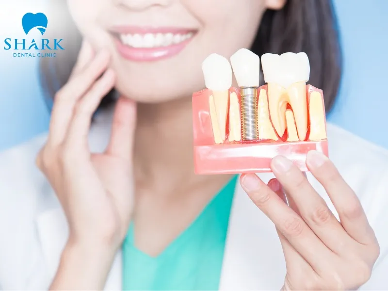 Before undergoing implant placement, you should carefully consider criteria such as restoration effectiveness, overall cost, and aesthetic outcomes to choose the most suitable option