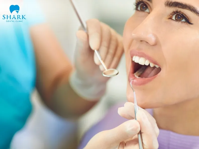 Currently, the cost of full-mouth dental implant treatment typically ranges from approximately 85,000,000 VND to 310,000,000 VND per case, depending on the treatment plan and implant system used