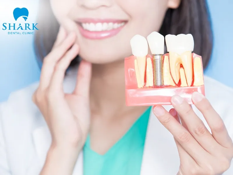Individuals experiencing jawbone loss or those with weaker oral health conditions may consider using implant supported dentures as a suitable restorative solution