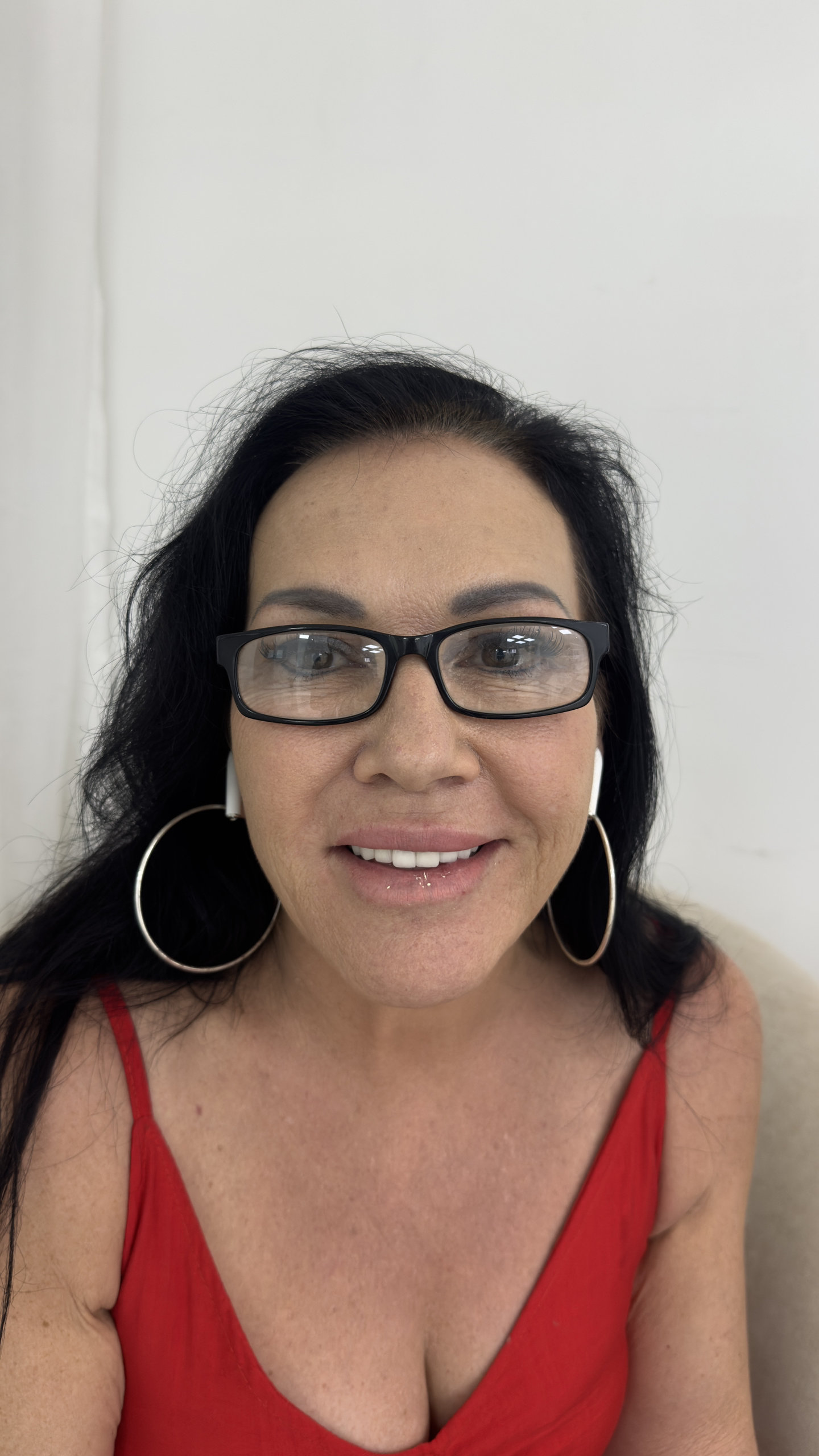 Client after procedure, front view