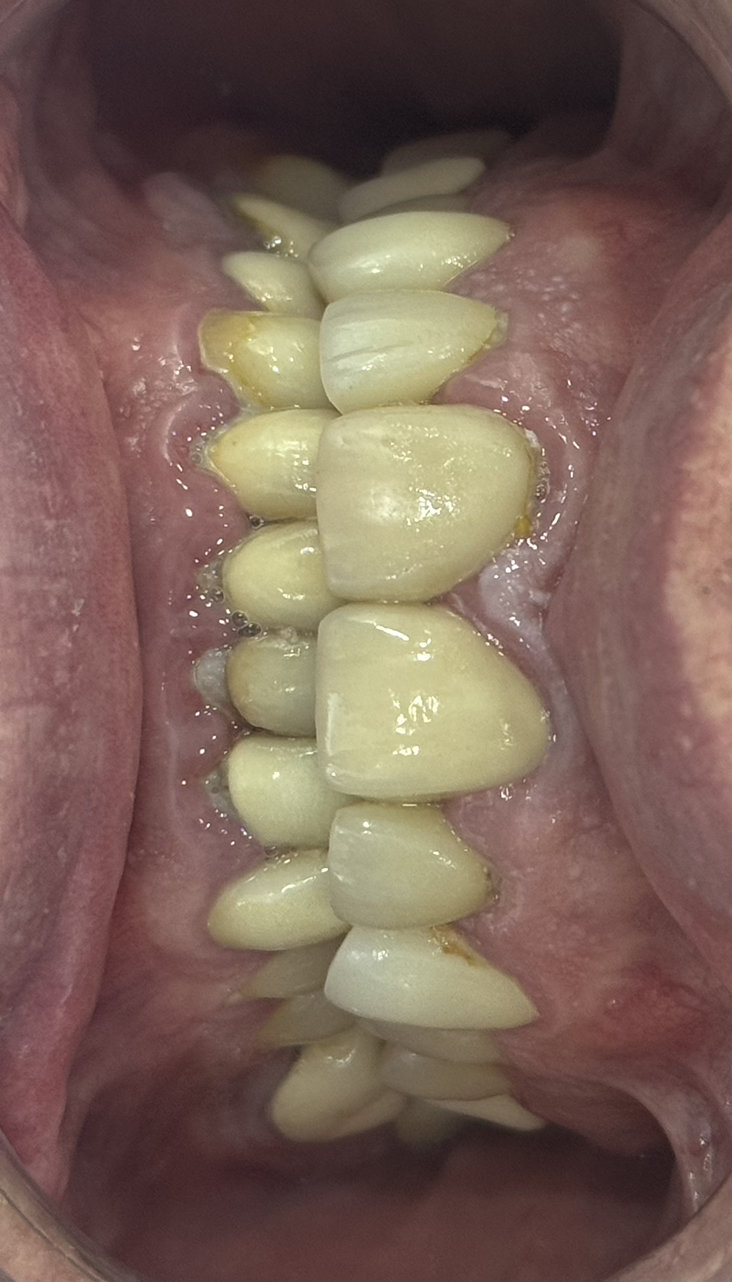 Client before procedure, front view