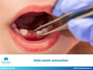 Kids tooth extraction: Guidelines for ensuring patient safety