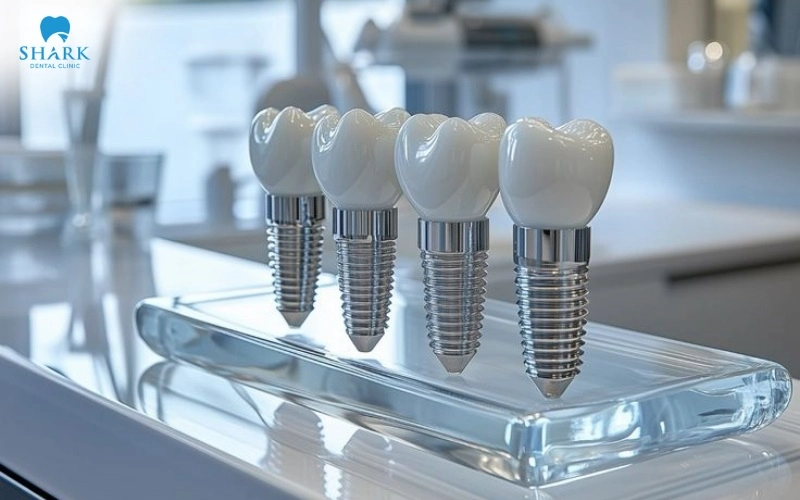 Each implant line at Shark Dental Clinic undergoes a rigorous selection process before being approved for clinical use