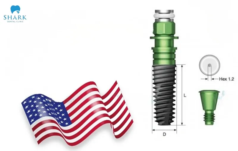 4 representative American implant lines that are commonly mentioned include Hiossen, Dentium, Nobel Biocare Active, and Nobel TiUltra, all of which are widely recognized in modern implant dentistry