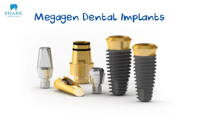 Megagen dental implant is considered a modern tooth restoration solution that delivers high effectiveness, dependable performance, and long-term treatment safety