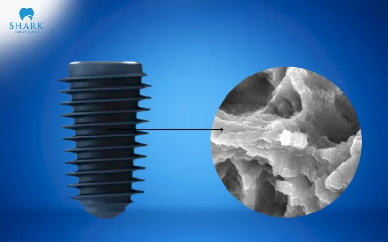 Megagen dental implant features exclusive XPEED surface treatment technology, helping create an ideal roughened surface structure for better integration