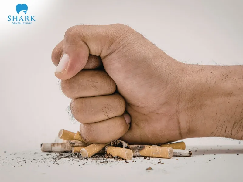 After getting porcelain veneers, it is important to limit or completely stop the habit of smoking, as it can affect both the color and longevity of the veneers