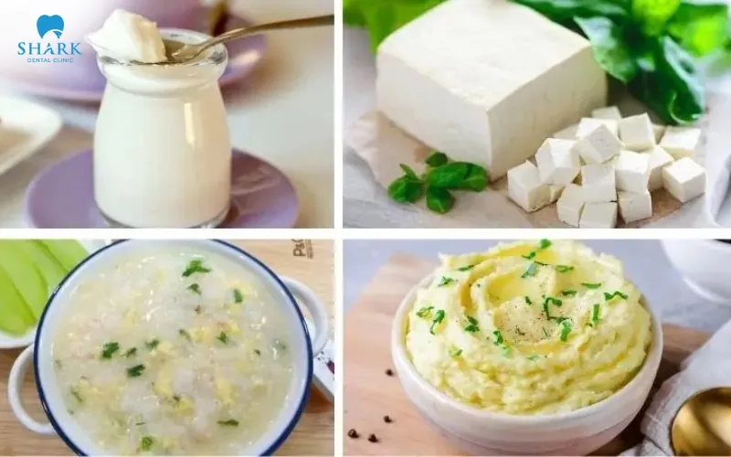 Soft foods should be prioritized during the first few days after extraction to help avoid disturbing the wound and to support a smoother healing process