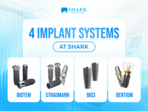Detailed comparison and comprehensive summary of the 4 implant brands