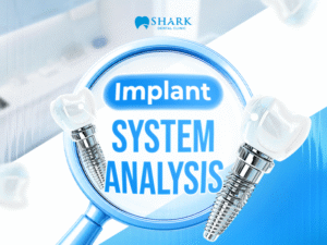 Detailed analysis of implant systems