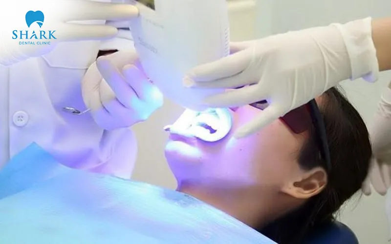 Teeth whitening blue light can be applied to a wide range of patients seeking cosmetic smile enhancement