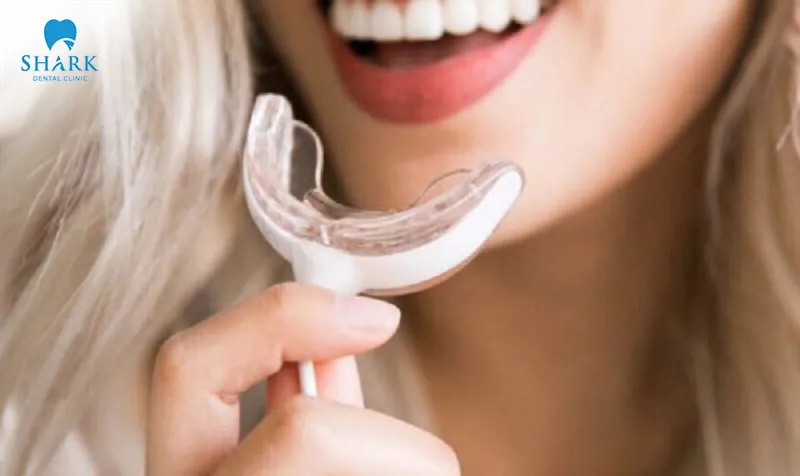 To achieve the best results and minimize the risk of side effects, blue light teeth whitening treatments should always be performed according to the manufacturer's instructions and recommended safety guidelines