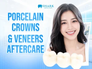 Post-treatment care instructions after dental crowns and porcelain veneers