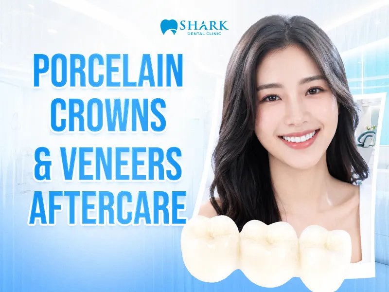 Post-treatment care instructions after dental crowns and porcelain veneers
