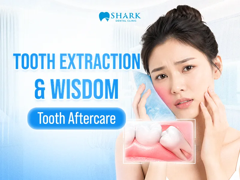 Post-treatment care instructions after tooth extraction and wisdom tooth removal
