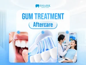 Post-treatment care instructions after gingivitis treatment
