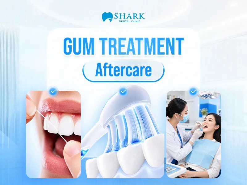 Post-treatment care instructions after gingivitis treatment
