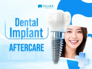 Post-treatment care instructions after dental implant placement