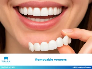 Are removable veneers really removable? Facts & real reviews