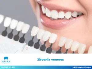 What are zirconia veneers? Advantages and disadvantages