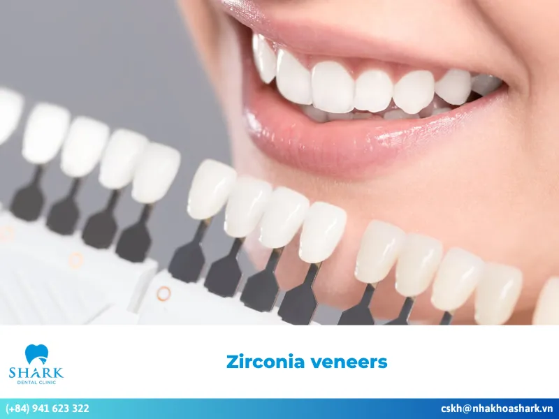 What are zirconia veneers? Advantages and disadvantages